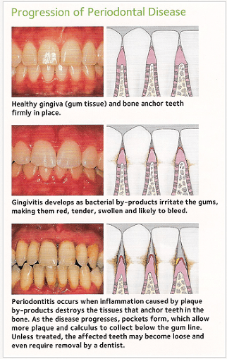 Preventative Dentistry Services | Digital Radiography Huber Heights