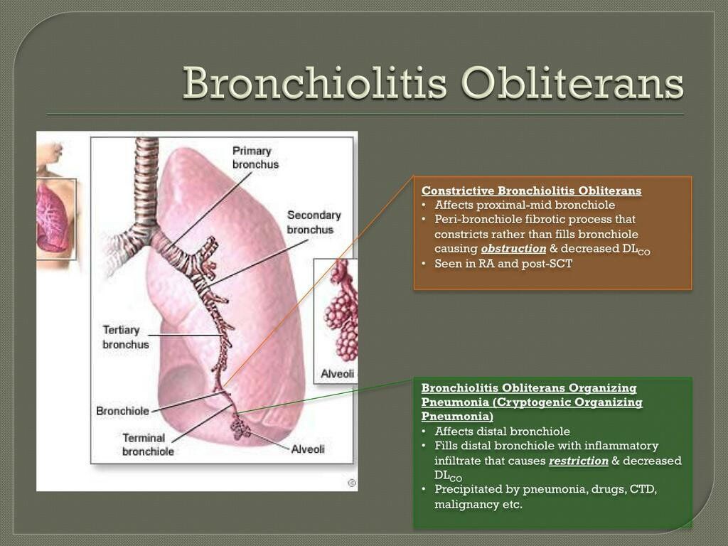 bronchiolitis-obliterans-medical-coverage-harrisburg-il